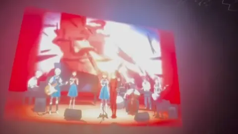 罗体训练遭遇不幸：拇指遭门柱反弹骨折